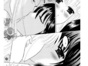 Palpitation
